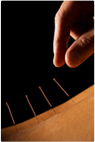 acupuncture-img